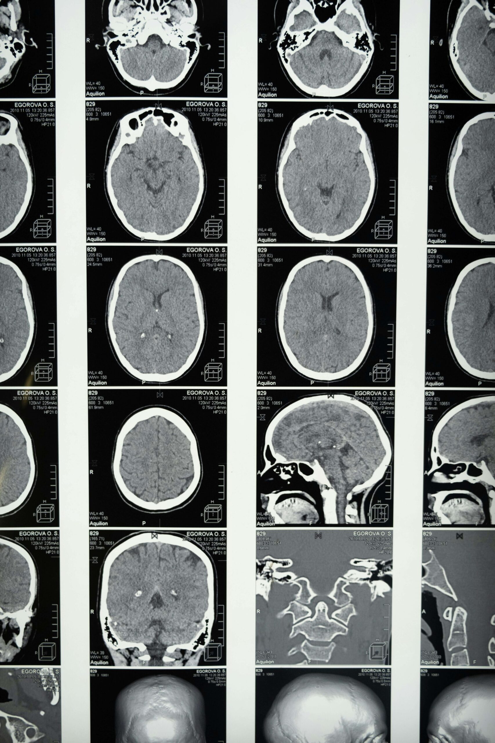 East Nashville brain injury lawyer