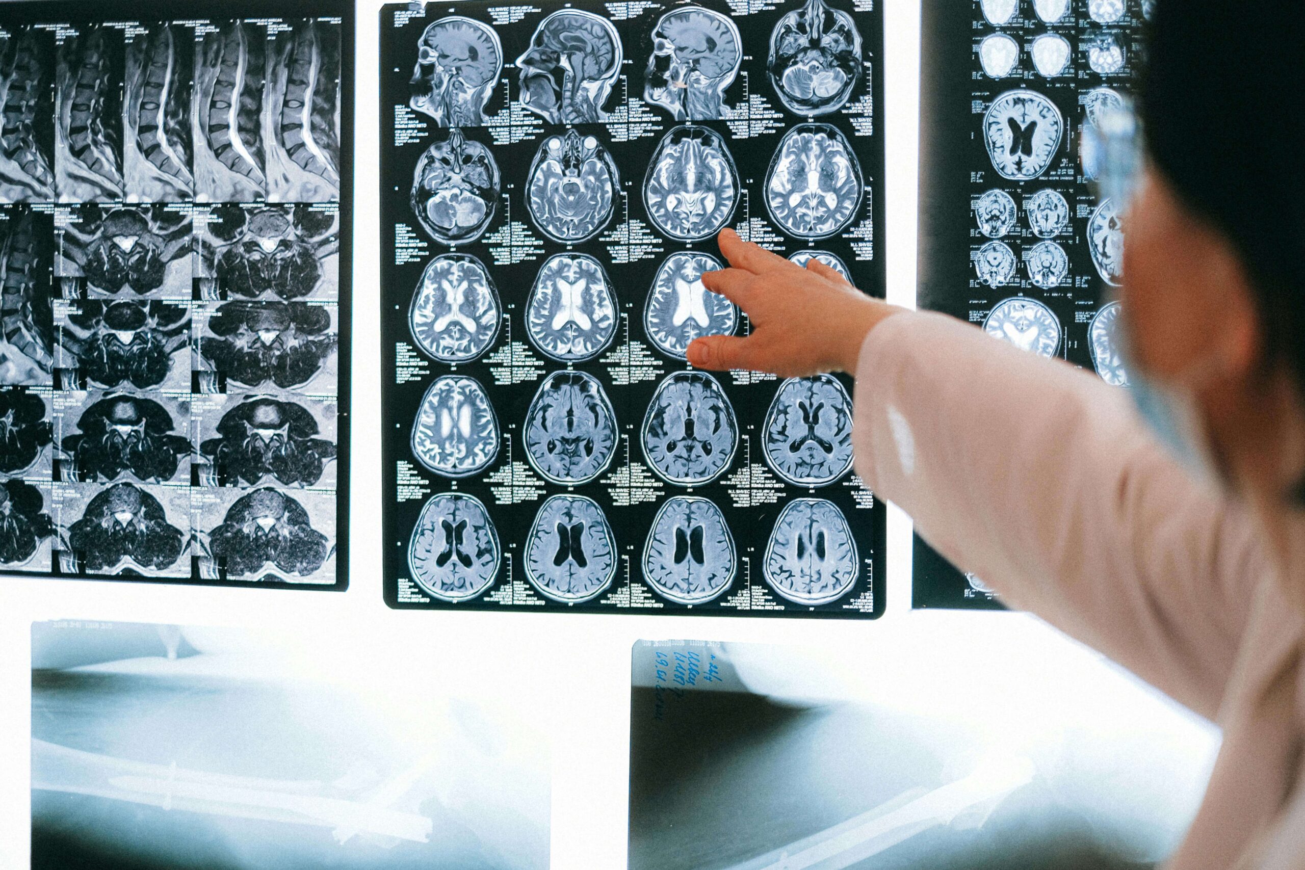 Nashville brain injury lawyer